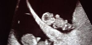 Andagt Mariæ bebudelse (I)